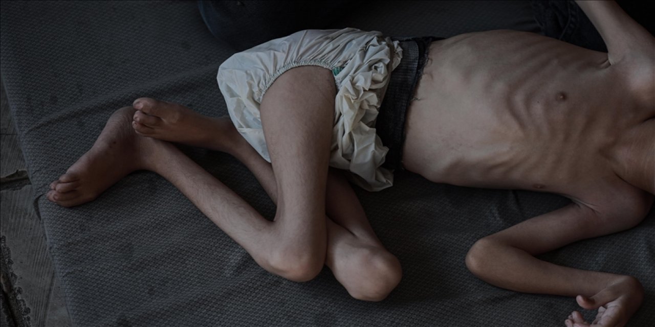 Katil belli: Gazze'de son 24 saatte 1'i çocuk 6 kişi daha açlıktan şehit oldu