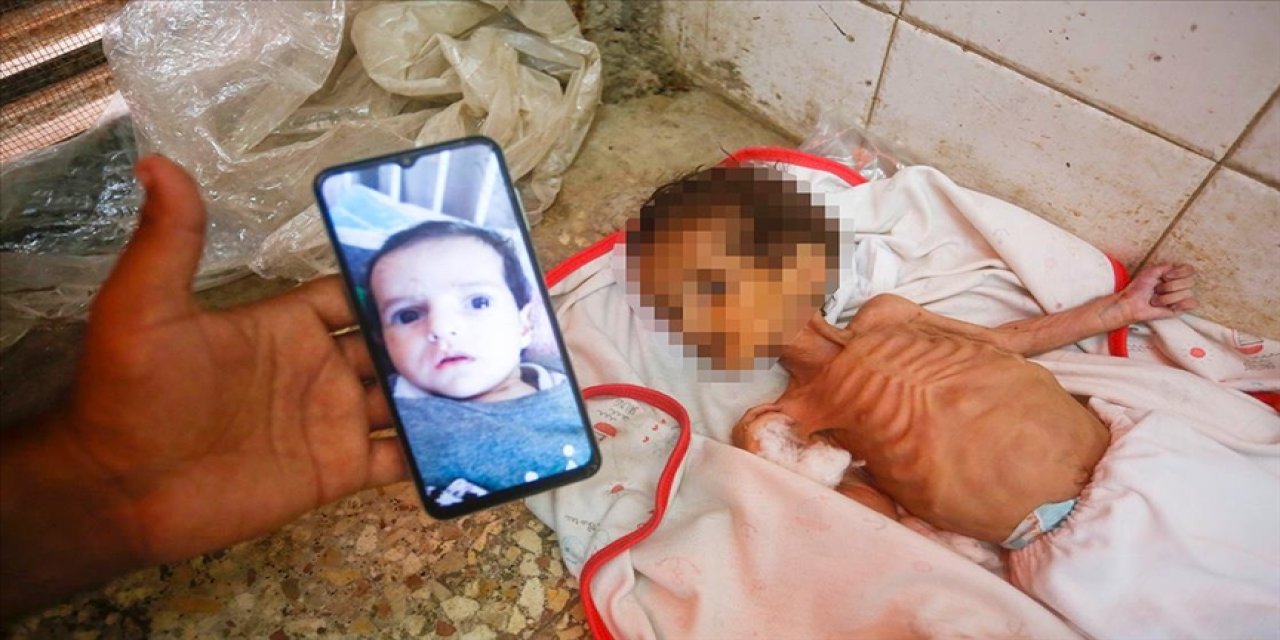 Katil israilin ablukası altındaki Gazze'de 3 aylık bebek Curi de açlıktan öldü
