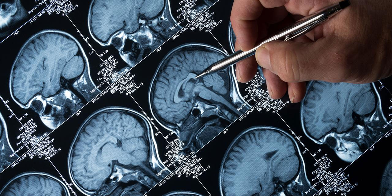 Alzheimer ve kanser, duyamadığımız seslerle tedavi edilebilir