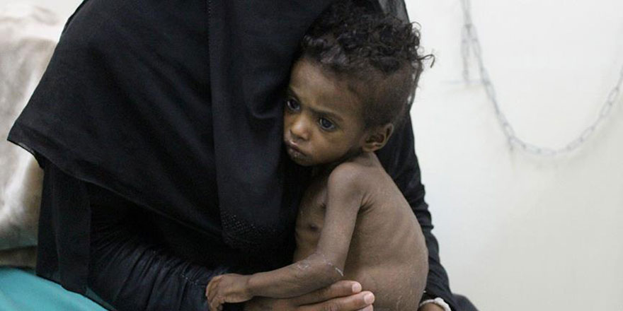 AB: Yemen kadınlar için dünyanın en zor ülkelerinden biri