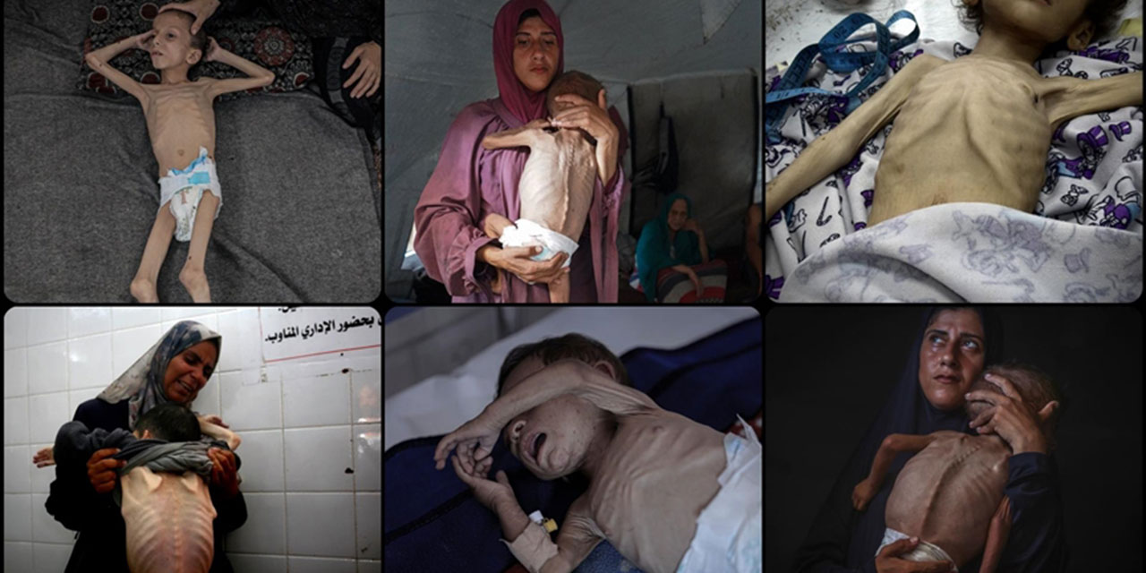 Gazze’de açlıktan şehit olanların sayısı 112'si çocuk, 271'e ulaştı