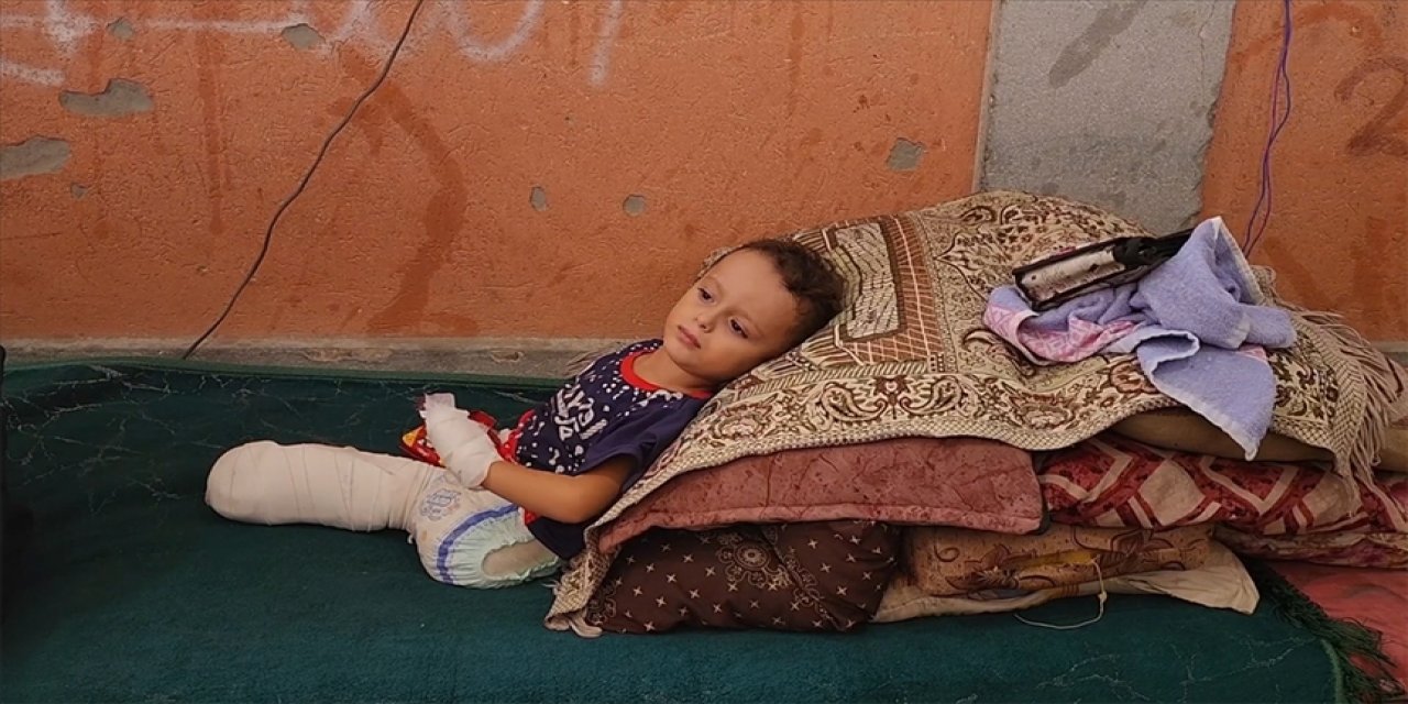 Katil israil saldırısında ayakları kopan 3 yaşındaki Yusuf annesinden her gün 'ayaklarını' istiyor
