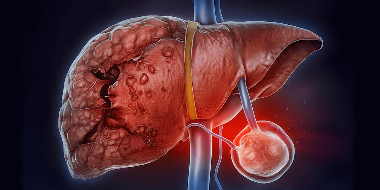 Köpeklerin yaydığı 'kist hidatik' öldürüyor