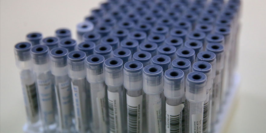 Bazı alanlarda PCR testi zorunluluğu kaldırıldı