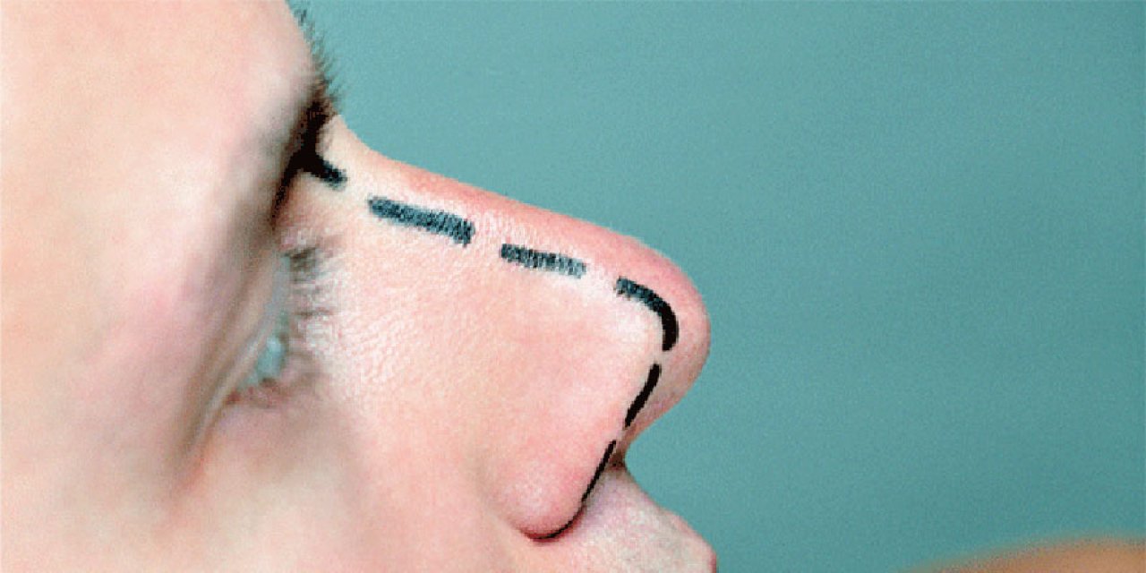 Estetik ameliyatı yaptırmanın dindeki yeri nedir? Estetik ameliyat günah mı?