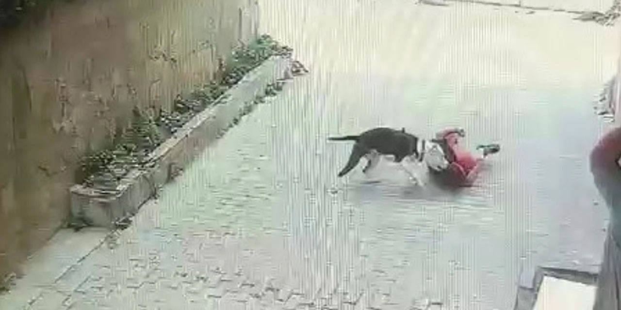 Köpek terörü İstanbul'da: Sokakta oynayan çocuğa pitbull saldırdı