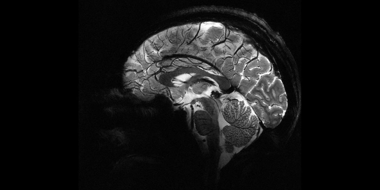 Bencillği azaltmak için beyne elektrik akımı verdiler: Sonuç şaşırtıcı