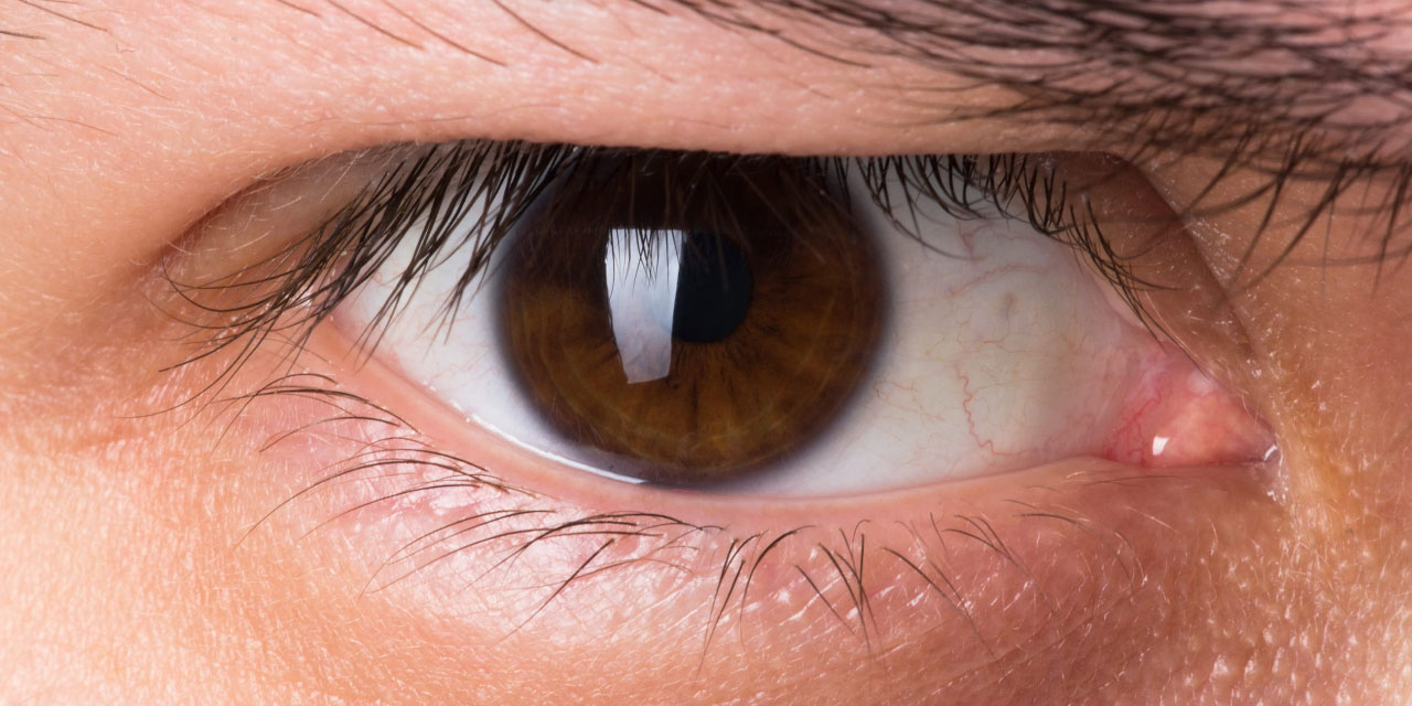 Gözden yapılan basit bir test, kalp krizini engelleyebilir