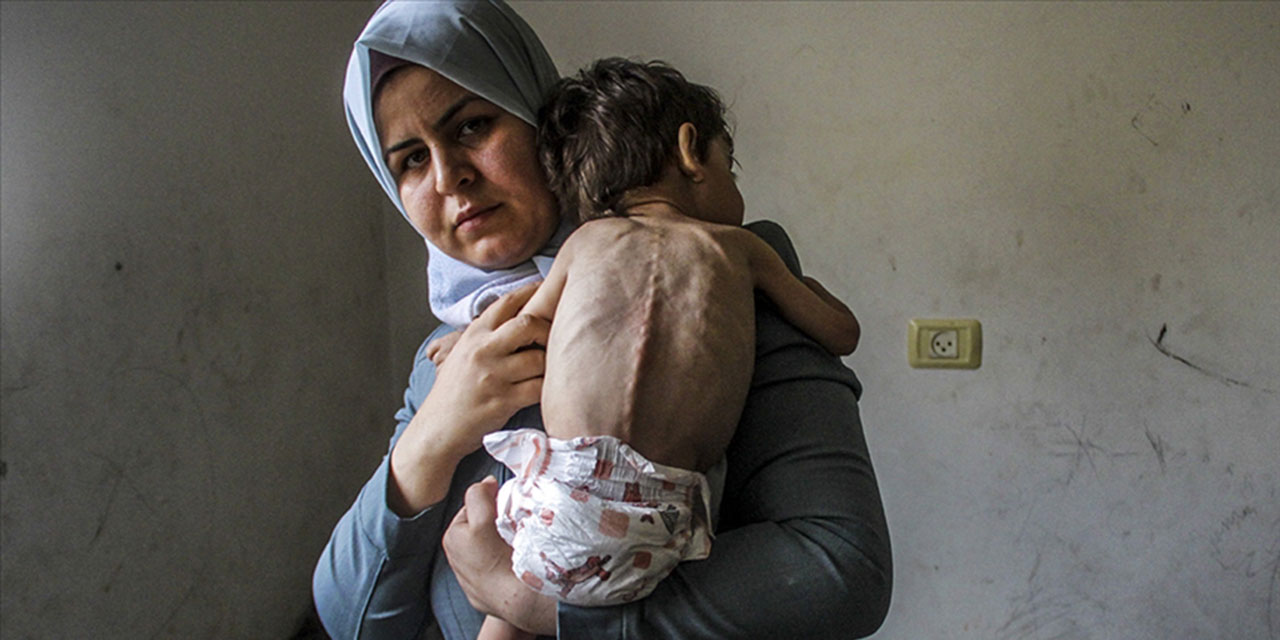 Gazze Şeridi'nde 3 bin 500 çocuk yetersiz beslenme nedeniyle ölüm tehlikesi altında