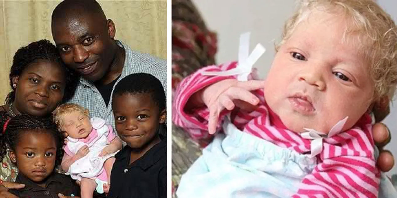 Hayrete düşüren bir haber ve 'hayret etmek' üzerine: Siyah anne-babadan sarışın çocuk!