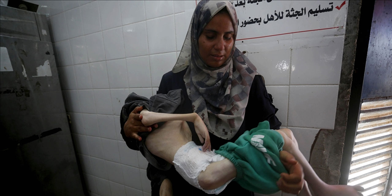 Filistinli 13 yaşındaki Tamir, annesinin kollarında açlıktan öldü