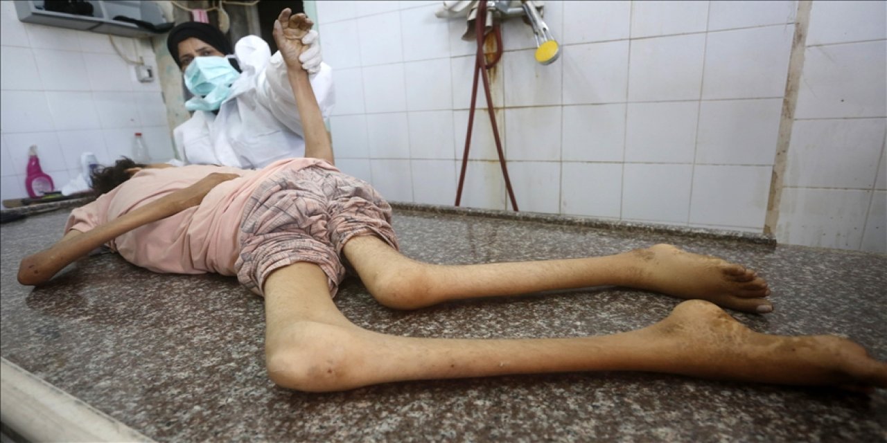 Gazze'de son 24 saatte 3'ü çocuk 9 kişi daha açlıktan şehit oldu