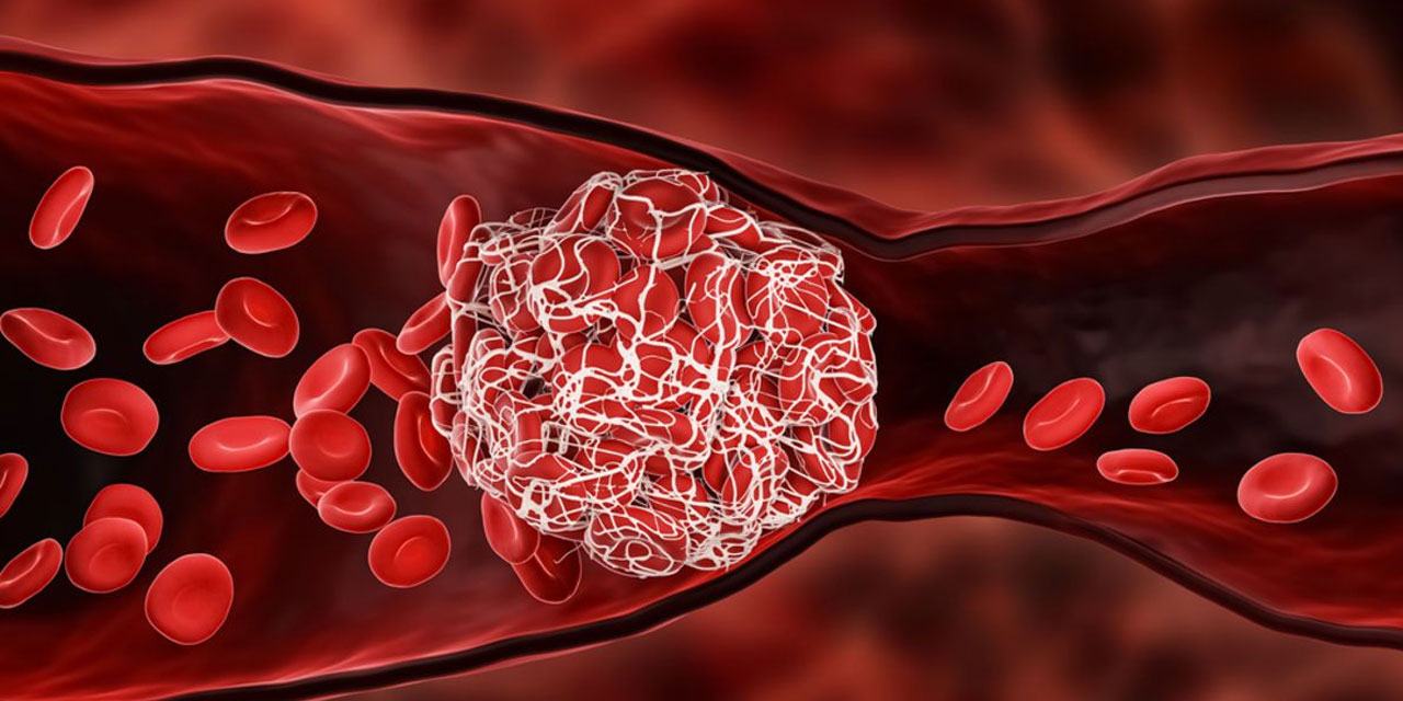 Gıda tatlandırıcıları, kandaki pıhtılaşma oranını yüzde 50 artırıyor