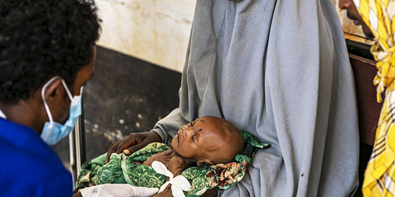 Somali'de hastaneler açlıktan ölüme sürüklenen çocuklarla dolu