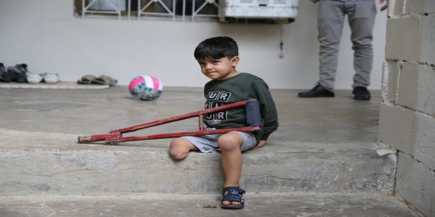 Suriyeli Minik Muhammed protez bacağına kavuştu