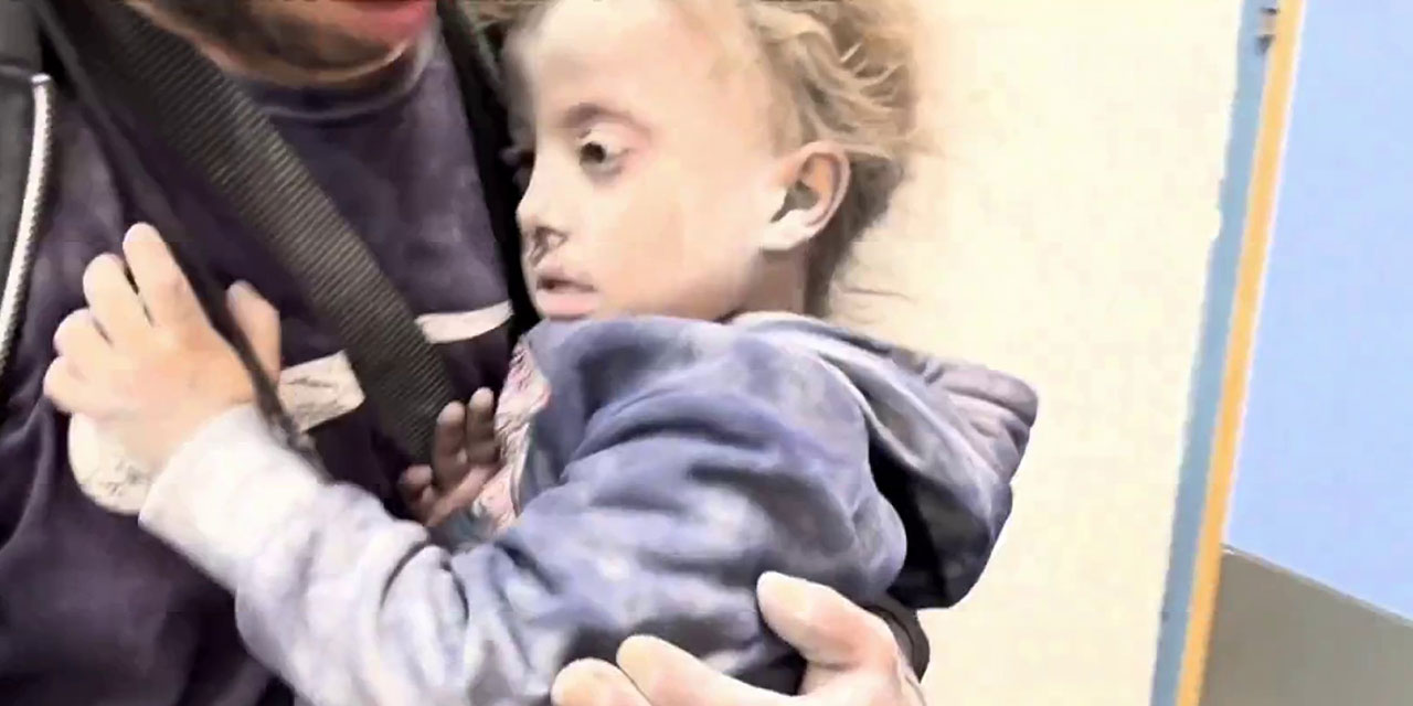 Gazze'de yetersiz beslenme nedeniyle 52 çocuk öldü