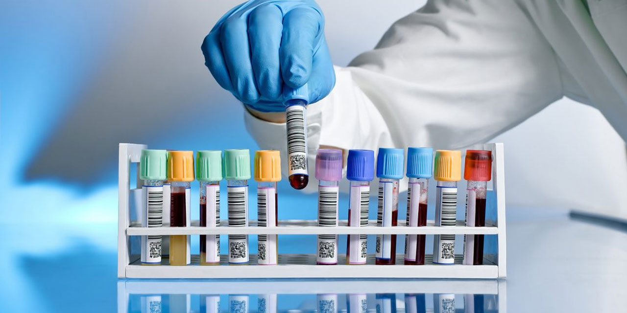 Onaylı Randevu Sistemi, tahliller için de uygulanacak