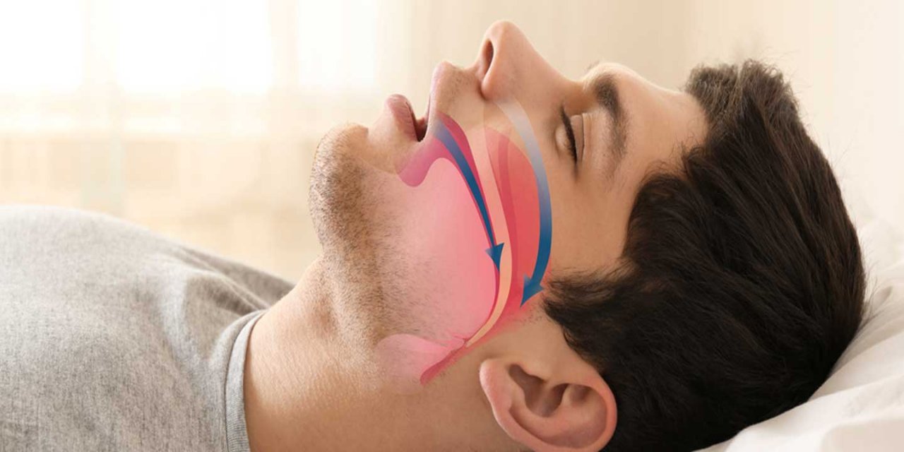 'Horlama kanser, damar hastalıkları ve bunama riskini arttırıyor'