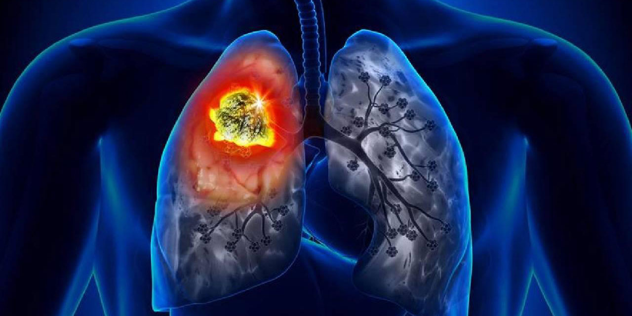 Kanseri daha iyi teşhis eden yapay zeka aracı geliştirildi