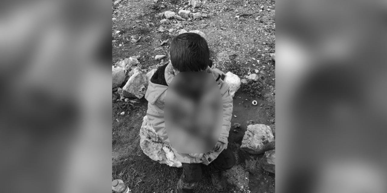 Başıboş köpeklerin saldırdığı çocuk ağır yaralandı