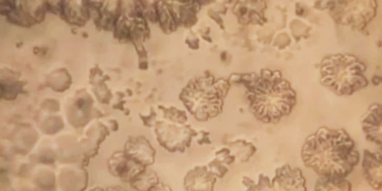 Zemzemi mikroskopta inceleyen genetik mühendisi şaşırdı