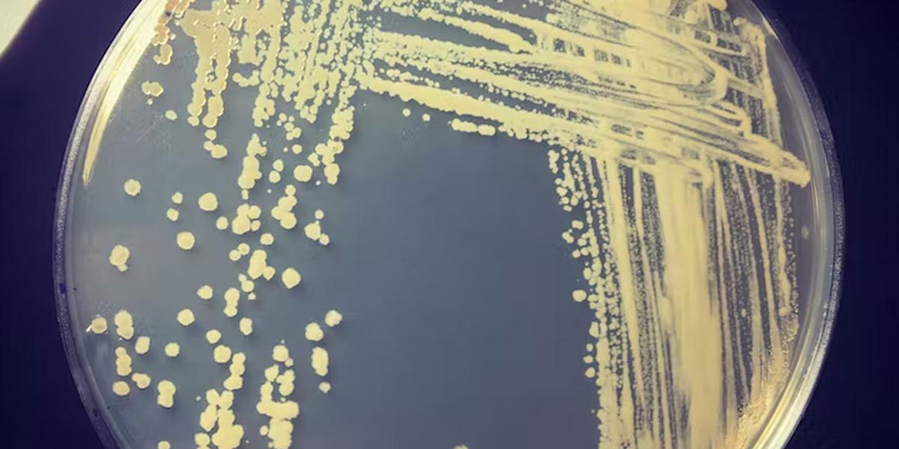 Hidrojenden elektrik üretebilen enzim bulundu