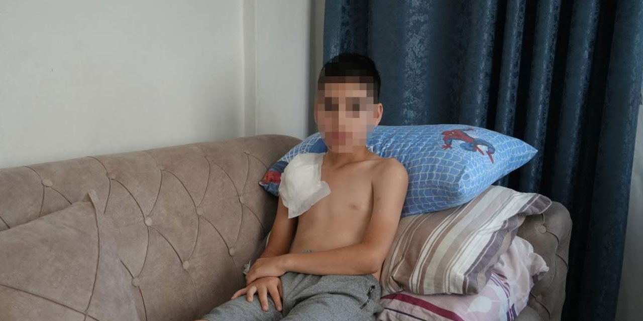 Samsun'da köpeğin saldırdığı 11 yaşındaki çocuğun kolu felç kaldı