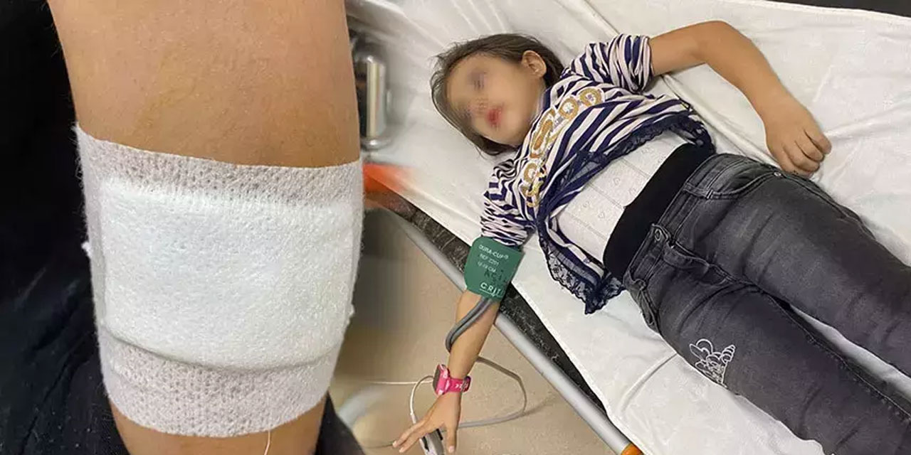 Müdür yardımcısı kafayı mı yemiş? Okul bahçesinde beslediği köpekler öğrenciye saldırdı