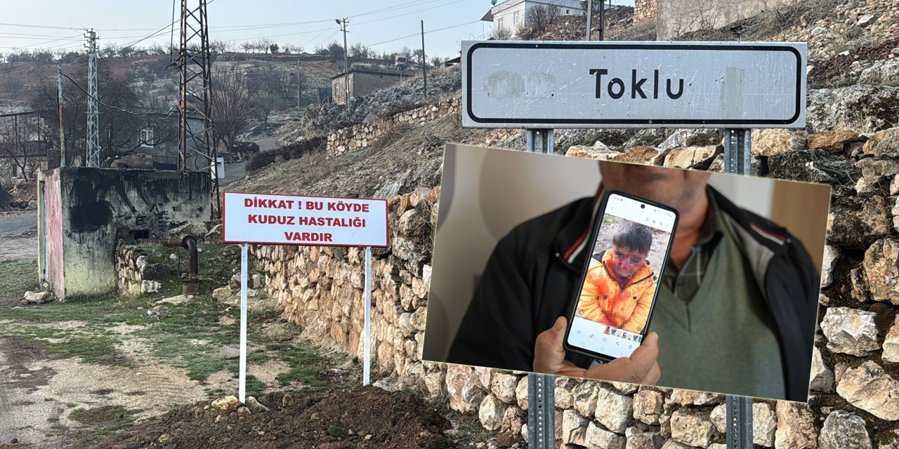 Belediyeler ve köpek lobileri masumların kanına giriyor: Çocuğa saldıran hayvan kuduz çıktı!