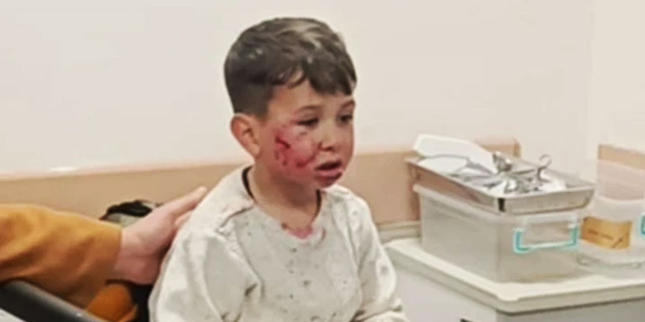 Köpekler 7 yaşındaki çocuğa oyun parkında saldırdı