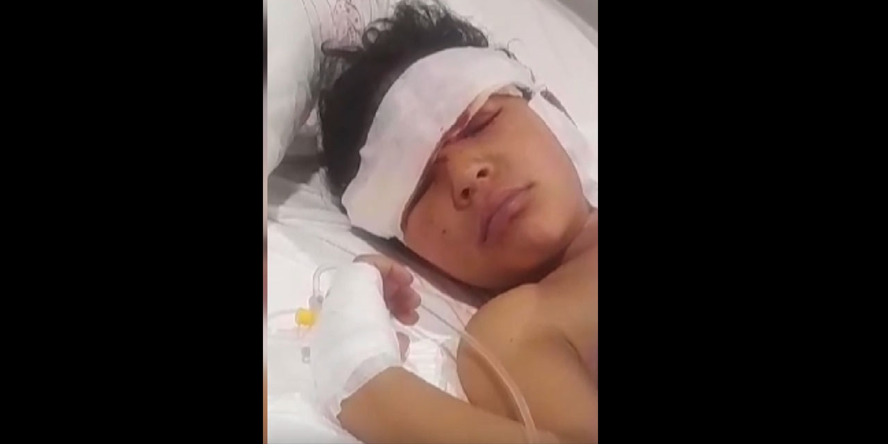 Daha kaç kişinin ölmesi gerekiyor? Ankara'da köpekler 5 yaşındaki çocuğun yüzünü parçaladı