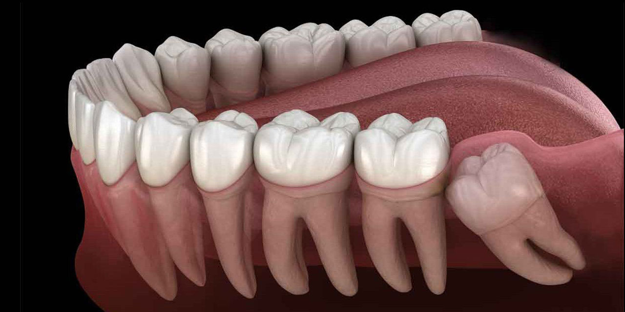 Japonlar, dişi yenileyebilen kök hücrelerin yaratıldığını keşfetti