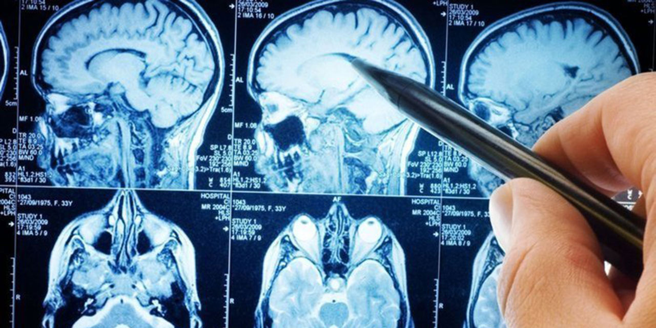 İki dili günlük hayatta akıcı konuşmak bunamayı azaltıyor