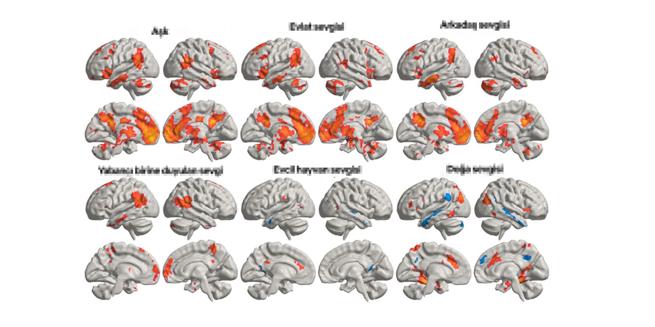 Her sevgi çeşidi, beynin farklı bölümlerini harekete geçiriyor