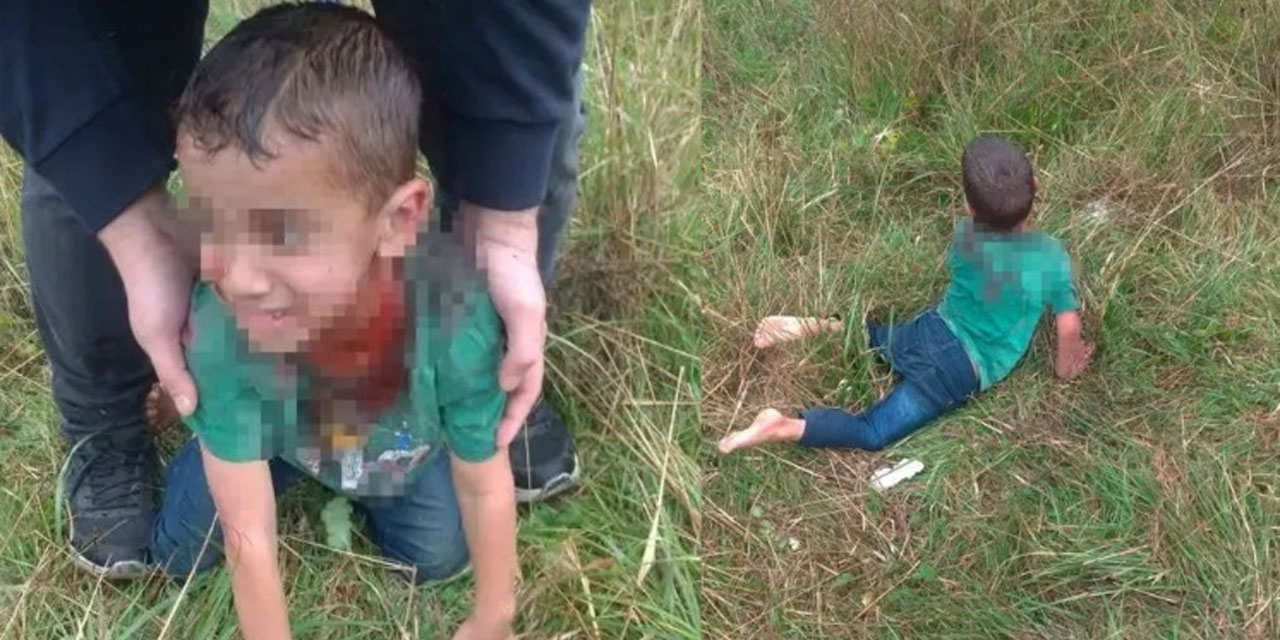 Yalova'da bakkala giderken köpeklerin saldırdığı çocuk ağır yaralandı