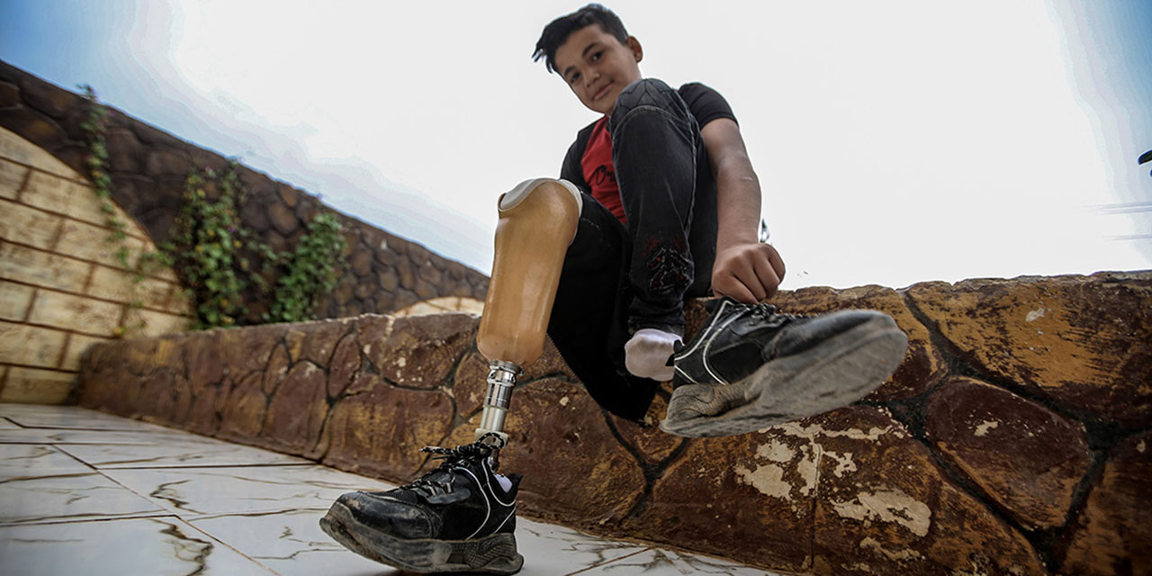 'Savaşın çocukları' arkadaşlarıyla eskisi gibi oynayıp koşmak istiyor