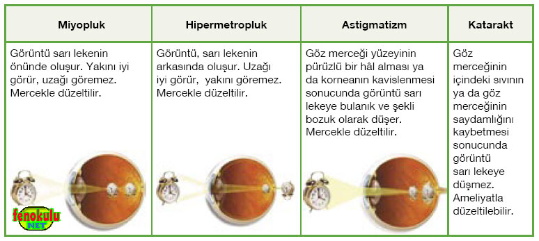 gozkusurlari.jpg