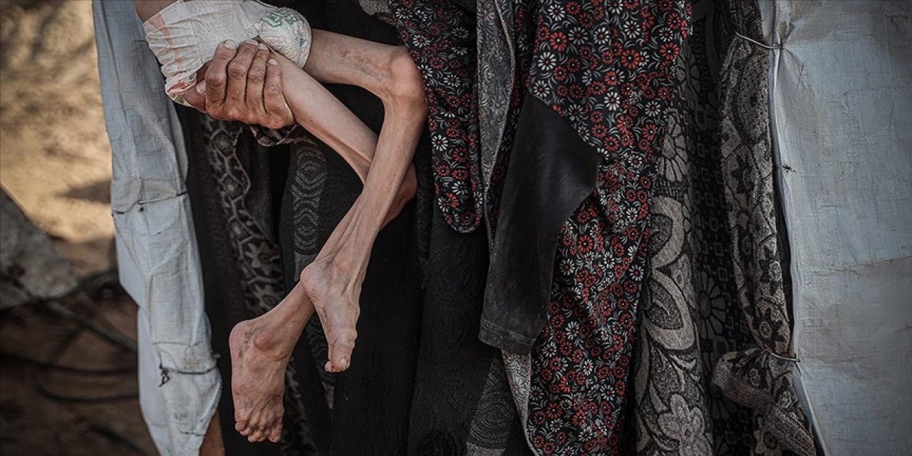 Soykırımcı israilin kıtlığı dayattığı Gazze'de 453 kişi açlıktan şehit oldu