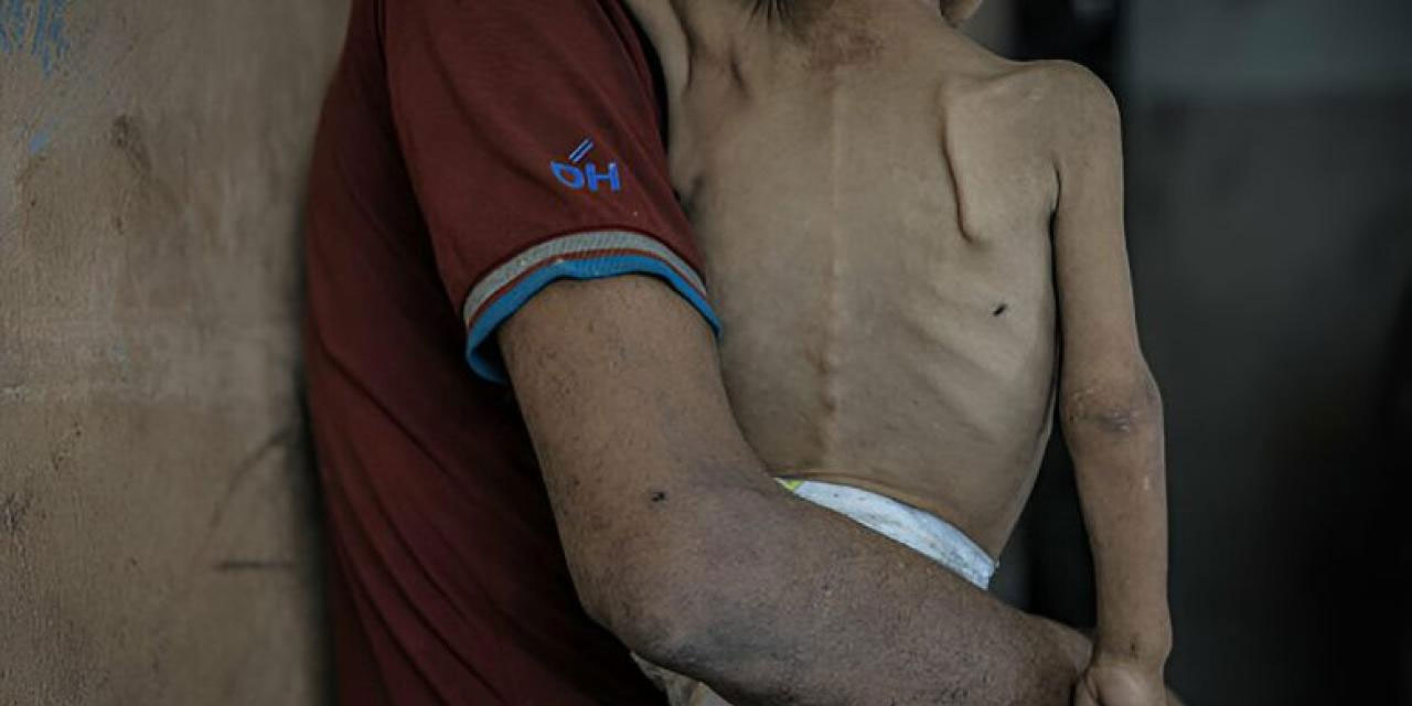 Katil israil: Gazze'de son 24 saatte 5 kişi daha açlıktan şehit oldu