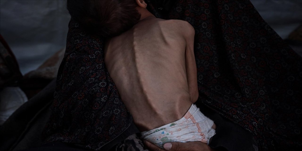 Gazze’de açlıktan şehit olanların sayısı 455’e yükseldi