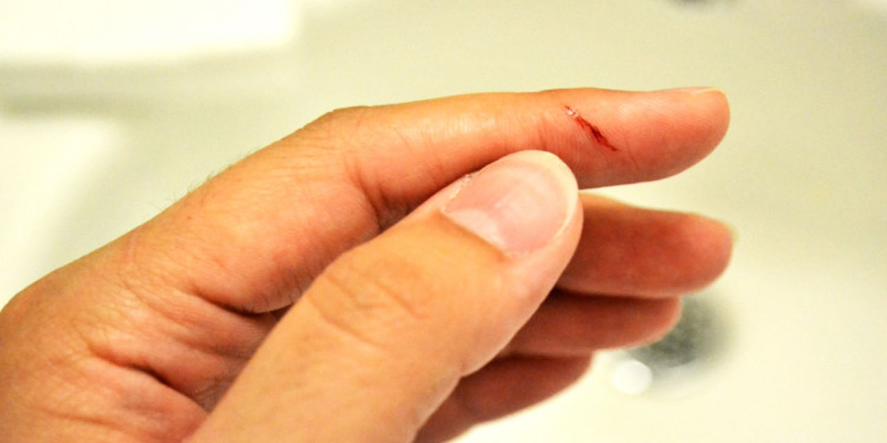 Kağıt kesiği niye daha fazla acı veriyor?